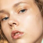 Acne Scars:  10 Expert Tips And Products To Help You Get Rid Of Them