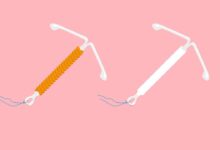 Alternatives To The Pill, Such As An IUD And Implant