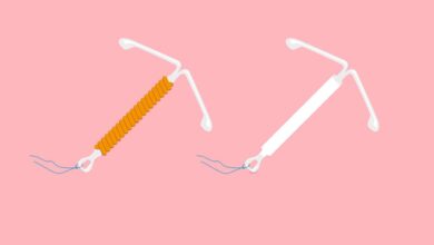 Alternatives To The Pill, Such As An IUD And Implant