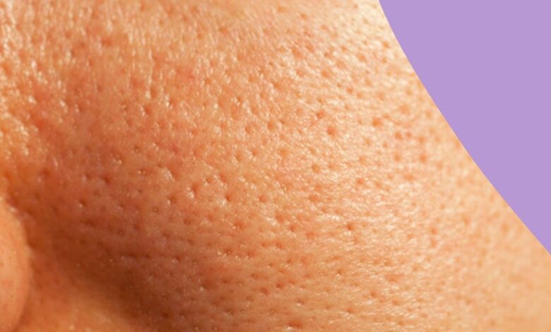 Clogged Pores: Causes & How To Treat Them, ASAP