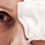 Woman wearing eye bandage