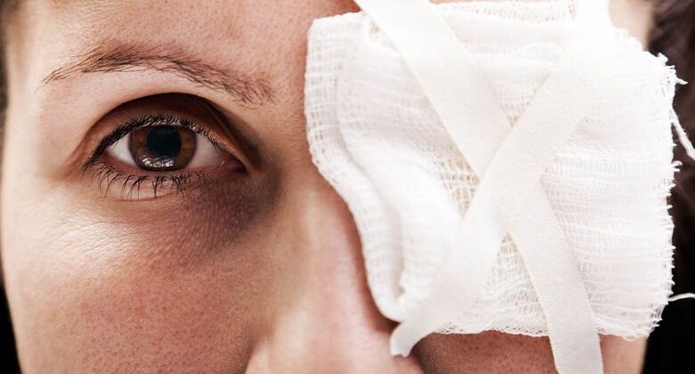 Woman wearing eye bandage