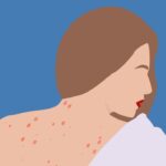 Red Spots On Skin: Here's What It Might Be, According To A Doctor