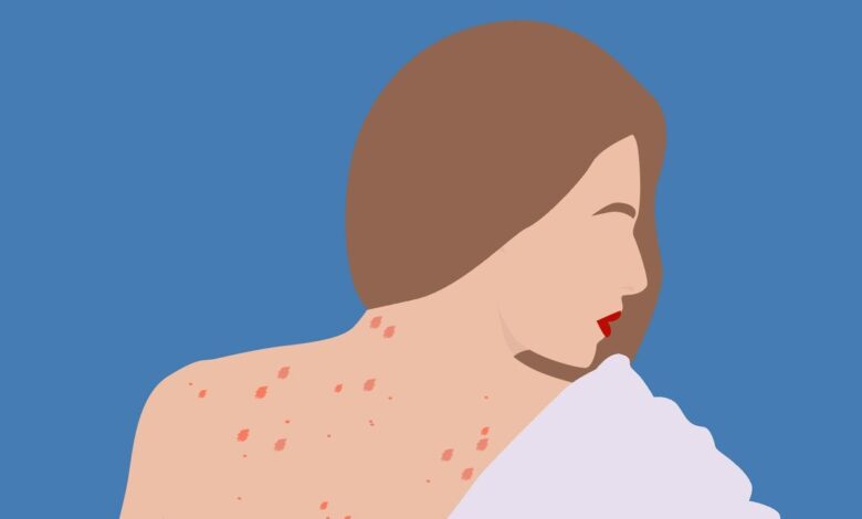 Red Spots On Skin: Here's What It Might Be, According To A Doctor