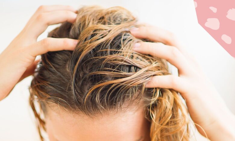 Scalp Acne: What Causes It And How To Treat It