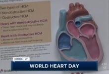 Wellness Wednesday: World Heart Day