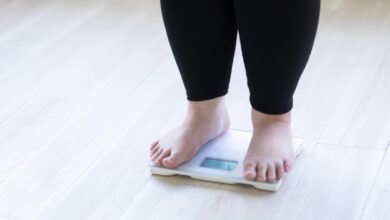 1 in 8 people worldwide are now obese. How is obesity measured?